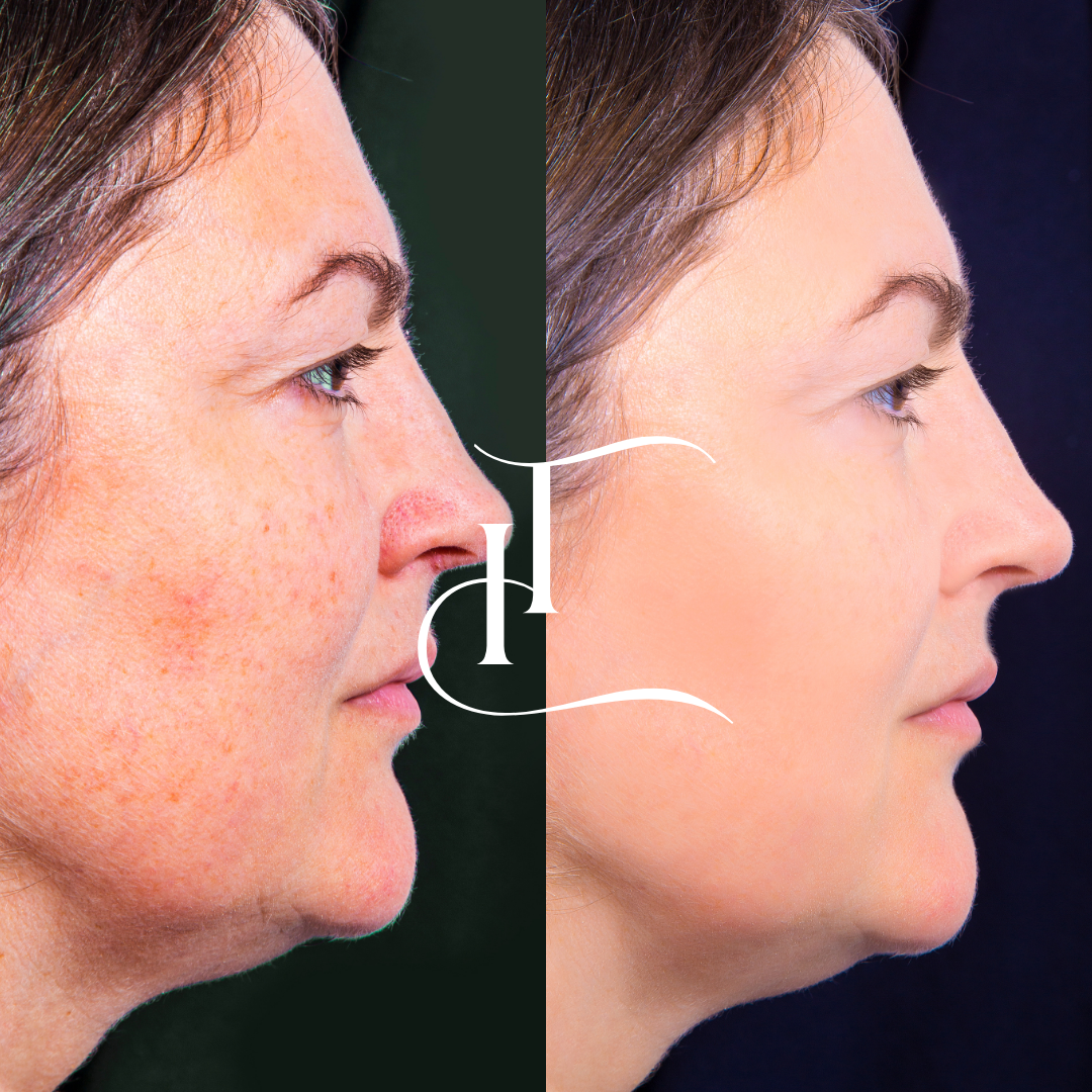 Especialista-em-Harmonizacao-Facial-19